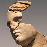 The Ancient Greek Roots of Medical Sexism